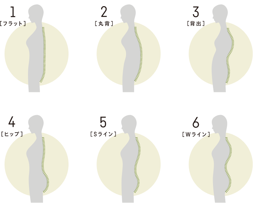背骨の形状6種類
